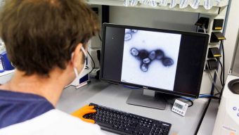 Unlikely monkeypox outbreak will lead to pandemic, says WHO